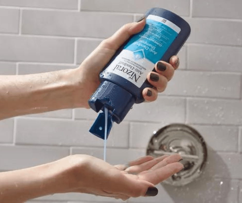 Dandruff relief? Here Are Some Tips From A Master Barber In Edmonton